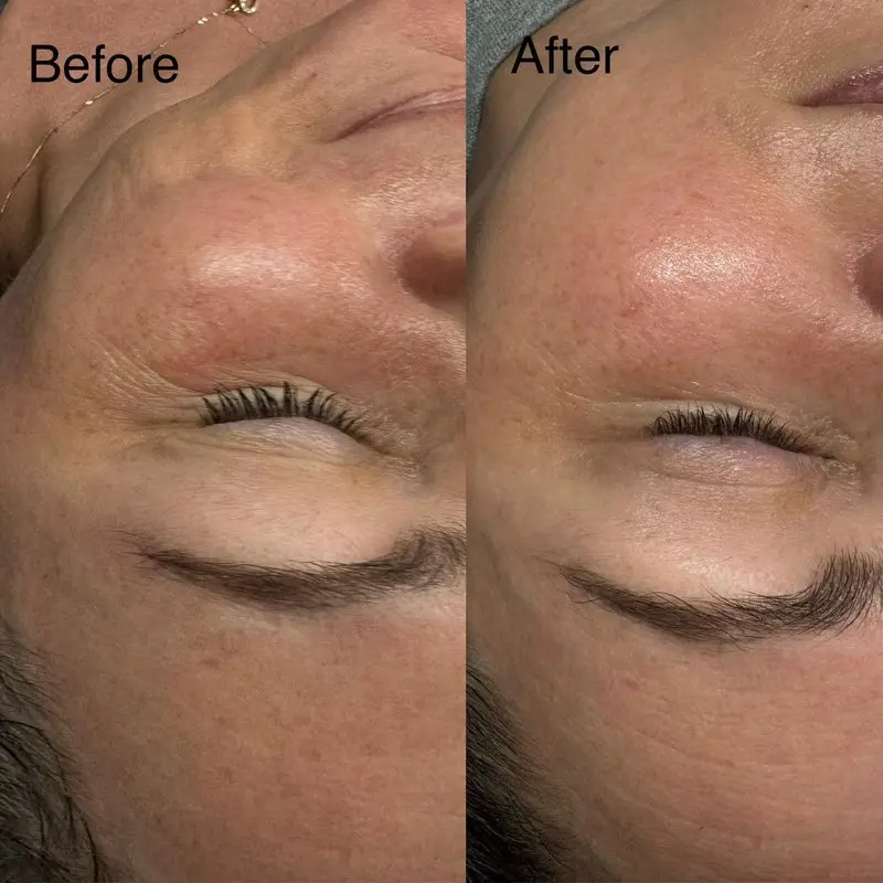Facial results before after skin transformation Boardman Ohio Royal Glow Beauty Esthetics